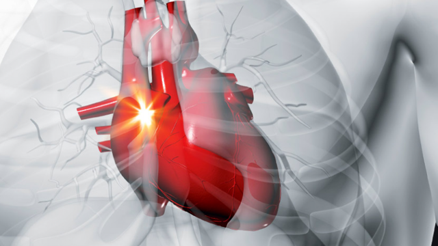 Лечение инфаркта и ишемической болезни сердца