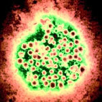 Факты и мифы о гепатите а