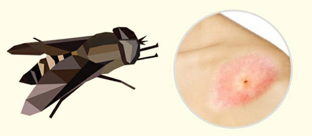 Безобидны ли укусы насекомых?