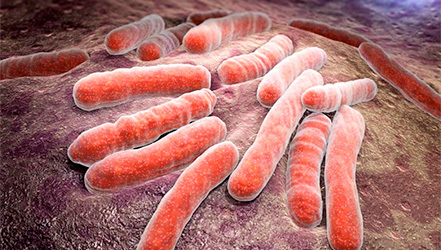 Питание при туберкулезе кожи