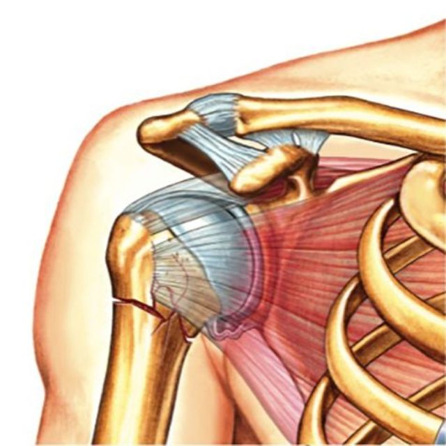 Перелом плечевой кости: правила первой помощи