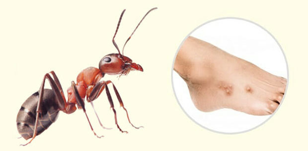 Безобидны ли укусы насекомых?