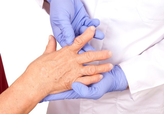 Ревматоидный артрит: диагностика и лечение