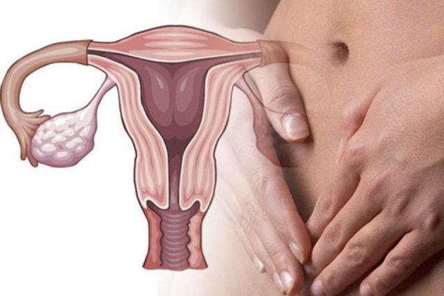Туберкулез женских половых органов