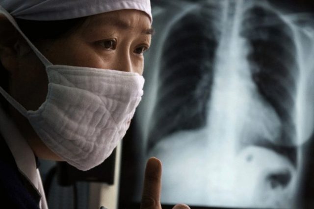Народная медицина против туберкулеза кожи