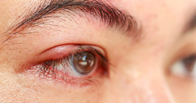 Симптомы болезней глаз