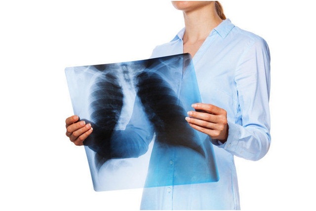 Общая информация и симптомы туберкулеза