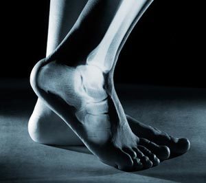 Симптомы болезней ног