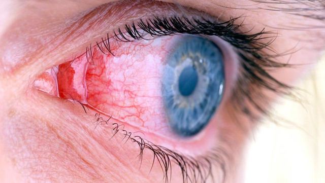 Симптомы болезней глаз